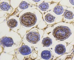 Smad3 (p Ser423, p Ser425) Rabbit anti-Human, Mouse, Clone: ST0493, Novus